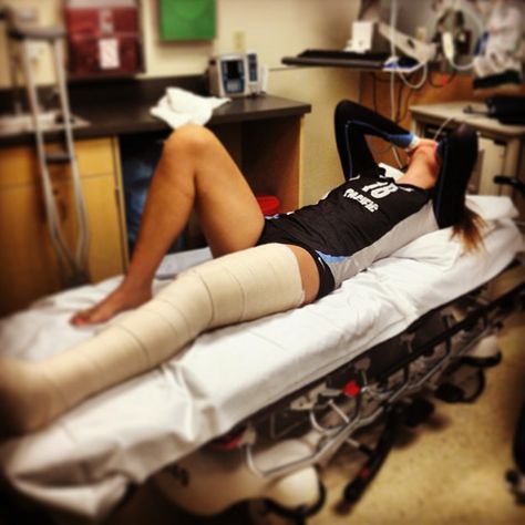 Broken Leg Cast, Fractured Leg, Leg Surgery, Injured Leg, Long Leg Cast, Hospital Admit, Orthopedic Brace, Arm Cast, Hospital Admit Hand Pics