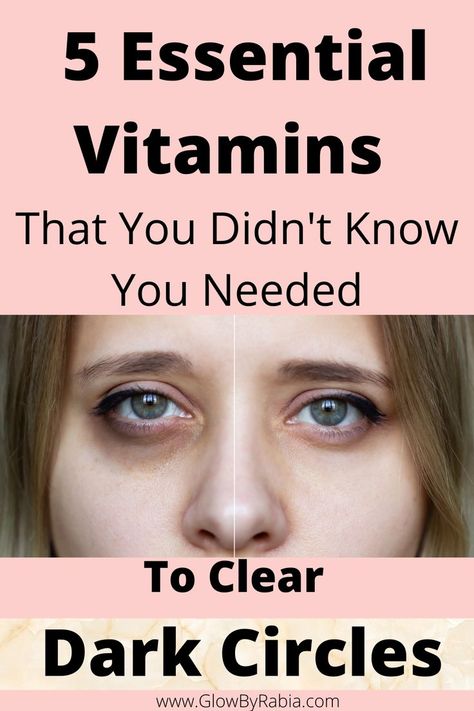 under eye dark circles Dark Circles Remedies, Eye Bag Remedies, Remove Eye Wrinkles, Eye Health Remedies, Under Eye Dark Circles, Eye Dark Circles, Eyes Dark Circles, Dark Circles Around Eyes, Dark Circle Remedies