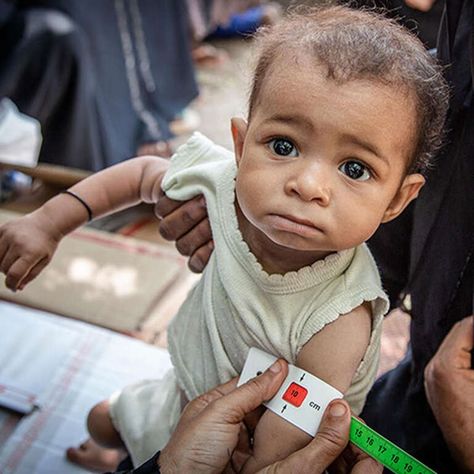 Preventing Malnutrition & Alleviating Hunger | Save the Children Everyday Prayers, Kids Nutrition, Focus On, Around The World, Nutrition, Health, Quick Saves