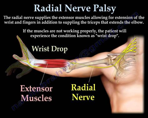 Peripheral Nerve Injury, Nerve Conduction Study, Radial Nerve, Median Nerve, Physiotherapy Clinic, Medication Management, Medical Anatomy, Hand Therapy, Anatomy And Physiology