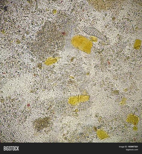 Undigestive muscle fiber in the human stool sample under microscopic examination Microscope Images, Muscle Fiber, Under Microscope, Stool Sample, Microscopic Images, Medical Laboratory, Nature Images, Lab, Stock Images