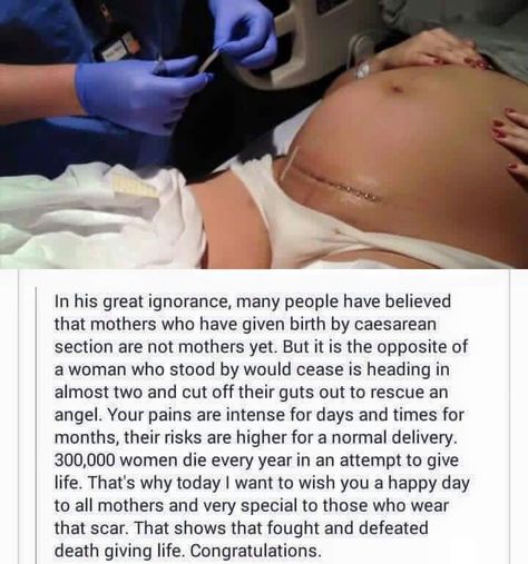 Birth Giving, Baby Captions, Emergency C Section, Mama Quotes, C Section Recovery, Pregnancy Belly Photos, Baby Delivery, Mommy Quotes, Mom Things