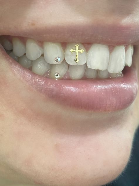 INSTAGRAM- @dreamgemzteeth 22kt gold Gothic cross Tooth gems Tooth gen technician Beauty Bodymod Teeth Jewelry Cross, Tooth Gen Aesthetic, Cross Tooth Gem, Teeth Jewelry Tooth Gems, Tooth Jewelry, Tooth Gems Aesthetic, Tooth Gems, Tooth Gems Ideas, Teeth Caps