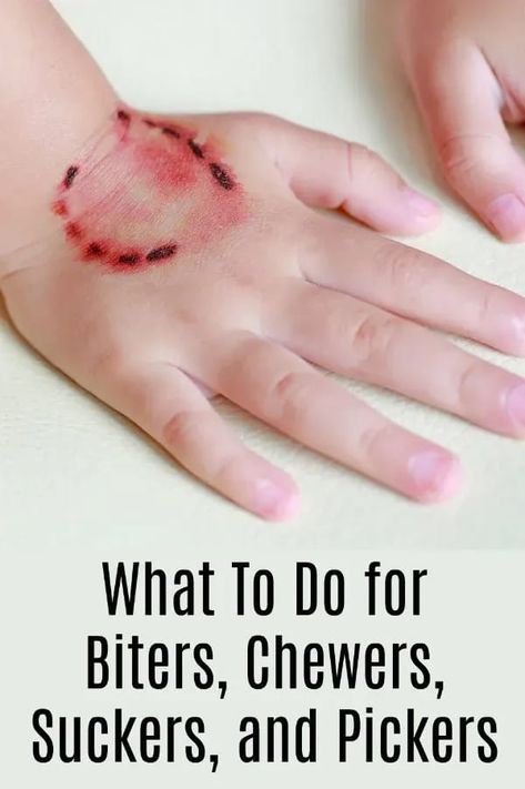 What To Do for Biters, Chewers, Suckers, and Pickers Health Quotes Wellness, Sensory Integration Activities, Quotes Wellness, Occupational Therapy Kids, Sensory Therapy, Sensory Diet, Occupational Therapy Activities, Toddler Biting, Oral Motor