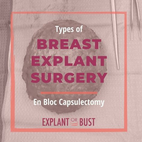 Explant Surgery Recovery, Breast Explant Before And After, Explant Surgery Before And After, Explant Surgery, Increase Breast Size, Mastectomy Recovery, Breast Lift Surgery, Breast Implant Illness, Silicone Implants