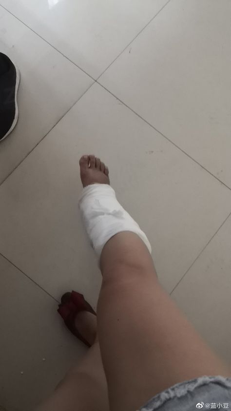 Leg Injury Fake Story, Girl Hand With Drip In Hospital, Hands With Drip In Hospital, Led Girls, Philippine Women, Diy Hot Tub, Leg Injury, Good Photo Editing Apps, Photo Editing Vsco