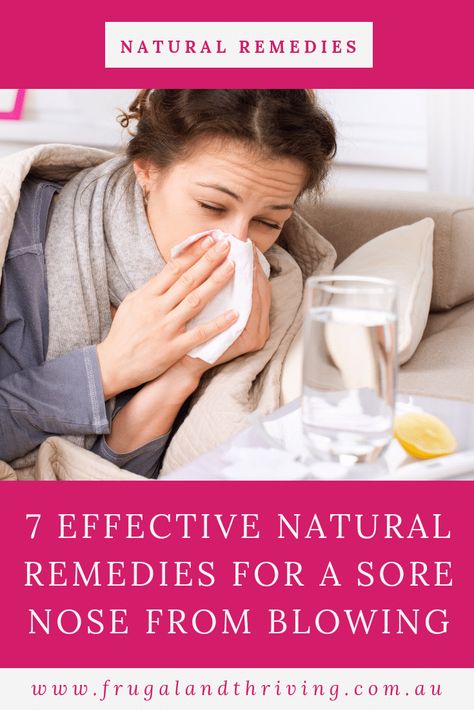 The only thing worse than a cold is also getting a sore, raw nose from blowing it all day! Here are seven effective natural remedies for a sore nose. #naturalskincare #diyskin #naturalremedies via @goodymel Raw Nose From Blowing Remedy, Nose Sores How To Heal, Chapped Nose Remedy, Dry Nose Remedy, Nose Sores, Skin Hacks, Best Cough Remedy, Baby Remedies, Sore Throat Remedies