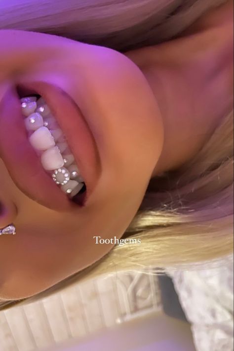 Rhinestone Retainer, How To Do Tooth Gems At Home, Tooth Gens Inspi, Bedazzled Teeth, Tooth Gems Simple, Piercing No Dente, Simple Tooth Gems Ideas, Teeth Gems Ideas, Dark Emo Pfp