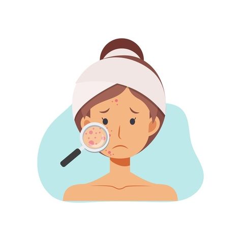 Illustration about acne skin problems co... | Premium Vector #Freepik #vector #woman #girl #cartoon #face Acne Illustration Art, Acne Illustration, Women Cartoon Characters, Skin Care Illustration, Skincare Illustration, Girl With Acne, Skin Illustration, Face Care Acne, Beauty Skin Quotes