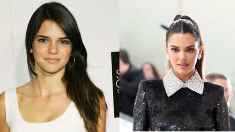 While Kendall Jenner has previously denied the rumor of getting plastic surgery multiple times, Reddit users recently discussed her transformation over the years and gave their opinions. Kendall Jenner Plastic Surgery, Plastic Surgery, Kendall Jenner, Next Level, Surgery, Over The Years