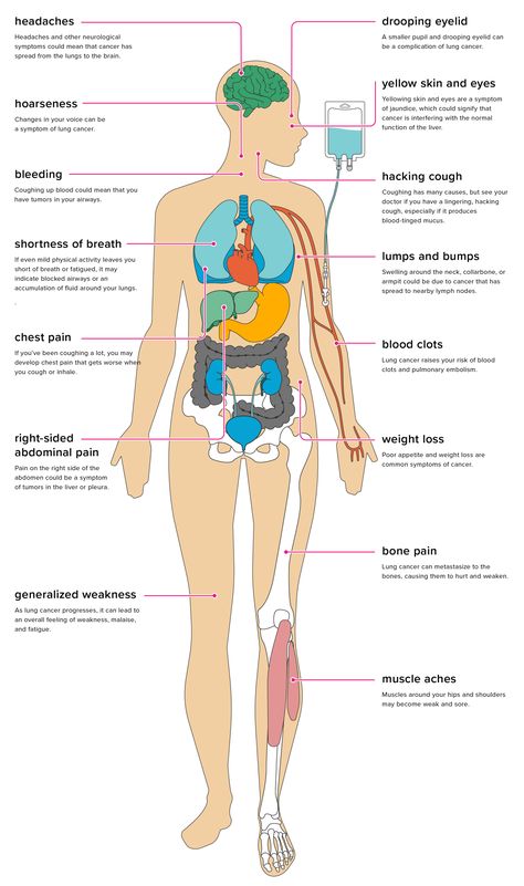 Chemo Nurse, Chemo Side Effects, Ways To Sleep Better, Chemo Care, Insomnia Causes, Oncology Nursing, Ways To Sleep, Memory Problems, How To Sleep