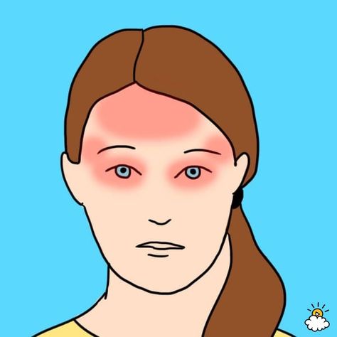 Headache Type 9: Digestive Issues Forehead Headache, Sinus Headache Remedies, Cluster Headache, Tmj Symptoms, Natural Remedies For Headaches, Oils For Headaches, Migraine Awareness, Caffeine Withdrawal, Chronic Sinusitis