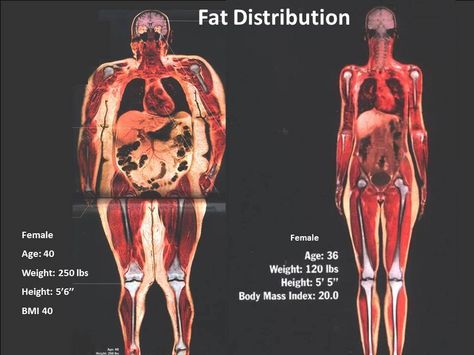 This is why Body Composition is so Important Basic Biology, Not Losing Weight, 120 Lbs, Physical Change, Body Composition, Good Mental Health, Fat To Fit, Losing 10 Pounds, 10 Pounds