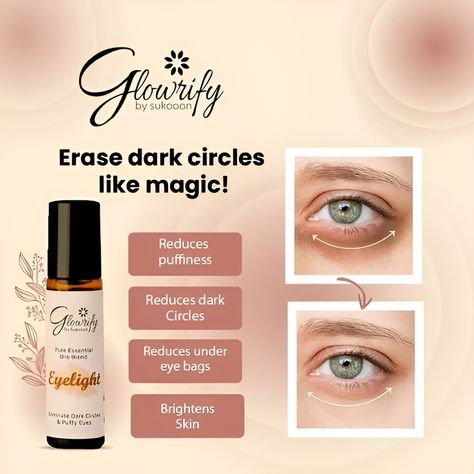 Glowrify Eyelight Serum - Eliminates Dark Circles Around Eyes & Puffy Eyes Eye Serum For Dark Circles, Serum For Dark Circles, Dark Circles Around Eyes, Reduce Dark Circles, Under Eye Bags, Puffy Eyes, Eye Serum, Dark Circles, Product Name