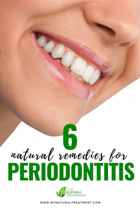 6 Natural Remedies for Periodontitis & Natural Tips #periodontitis #periodontitishomeremedies #periodontitisremedy #periodontitisremedies #periodontitiscure #periodontitistreatment #periodontitisherbs Natural Remedies For Periodontal Disease, Periodontal Disease Remedies, Perfect Teeth Braces, Teeth Diseases, Thyme Tea, Teeth Aesthetic, Teeth Remedies, Dental Health Care, Teeth Whitening Remedies