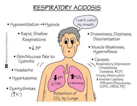 Respiratory Acidosis is an acid-base imbalance characterized by increased partial pressure of arterial carbon dioxide and decreased blood pH. Respiratory Acidosis, The Human Body, Lungs, Respiratory, Nursing, Human Body, Human