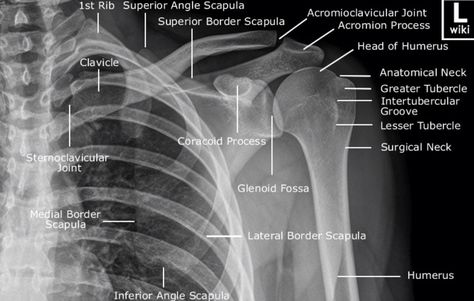 AP of the shoulder Xray Anatomy, Radiology Schools, Shoulder Anatomy, Radiologic Technology, Radiology Student, Radiology Imaging, Radiology Technologist, Diagnostic Imaging, Medical Imaging