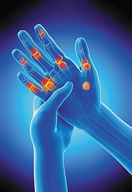 Identifying arthritis in your fingers and thumbs - Harvard Health 2 Joints Hand Sign, Hand Pain, Pinturas Disney, Nerve Pain, Cold Therapy, Get A Tattoo, Hand Tattoos, How To Draw Hands, Health