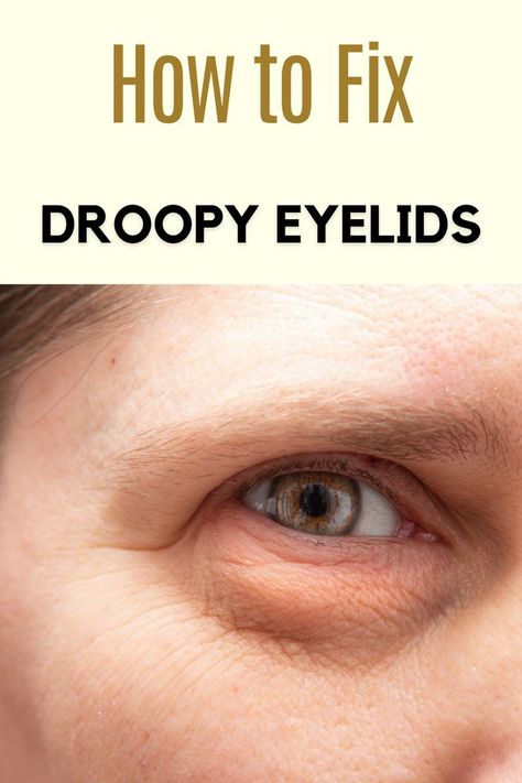 Fix Droopy Eyelids, Saggy Eyes, Saggy Eyelids, Pro Makeup Tips, Cloves Benefits, Droopy Eyelids, Fitness Beauty, Makeup Inspo, Getting Old