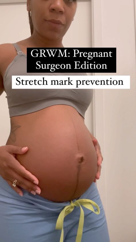 Ebone Bady, M.D. on Instagram: “Let’s talk about STRETCH MARKS! Our bodies truly go through an amazing changes during pregnancy. Stretch marks is a topic not fully…” Stretch Mark Pregnancy Prevent, Stretch Mark Prevention Pregnancy, Stretch Mark Remedies, Mommy Tips, Stretch Mark Removal, Stretch Mark Cream, Stretch Mark, Ancient Egyptians, Linnet