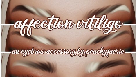 Sims 4 Cc Peachyfaerie, Sims 4 Cc Vitigilo, Sims4 Aesthetic, Patchy Skin, The Sims 4 Skin, Sims 4 Cc Skin, Sims Games, Sims Hair, Cc Sims