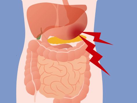 Cranial Nerves, Integrative Medicine, Stomach Pain, Types Of Cancers, Chest Pain, Abdominal Pain, Cognitive Behavioral Therapy, Behavioral Therapy, Better Sleep