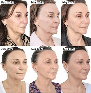 Strictly's Shirley Ballas' age-defying transformation: before and after - exclusive | HELLO! Sarah Parish, Good Jawline, Shirley Ballas, Jacqueline Jossa, Gemma Collins, Under The Knife, Strictly Come Dancing, Age Defying, Eyeshadow Tutorial