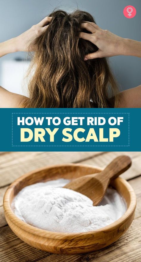 Dry Patches On Scalp, How To Help Dry Scalp, How To Treat Dry Scalp, How To Get Rid Of Dry Scalp, Get Rid Of Dry Scalp, Extremely Dry Scalp, Dry Scalp Shampoo, Dry Scalp Remedy, Hair Fairy