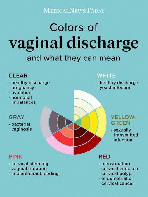 Feminine Health, Color Guide, Medical News, Medical Knowledge, Healthy Pregnancy, Health Facts, Health Remedies, Body Health, Womens Health