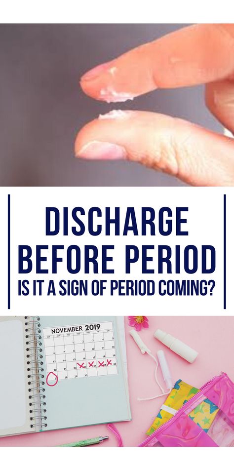 Discharge Female Chart Color, What Discharge Colors Mean, White Sticky Discharge, Tips During Period, What Does Different Color Discharge Mean, Cervical Mucus Before Period, Discharge Color Meaning Chart, Period Discharge Chart, Sign Your Period Is Coming Soon