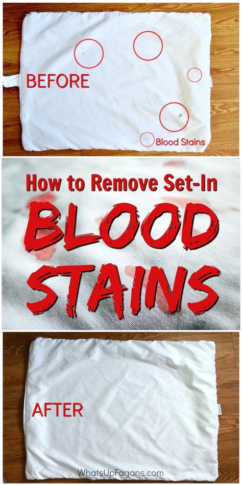 blood stain removal method with ammonia - hot iron laundry stain removal - how to get rid of blood stain on fabric, clothes, sheets, pillow case with ammonia, cleaning tutorial tip, hydrogen peroxide Get Blood Out Of Sheets, Removing Blood Stains, Blood Stain Removal, Blood Stain, Homemade Toilet Cleaner, Clean Baking Pans, Fabric Clothes, Cleaning Painted Walls, Laundry Stains