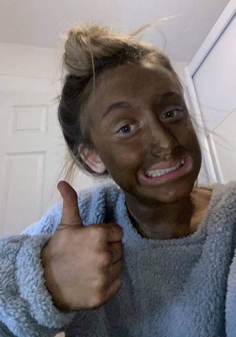 Dark Fake Tan, Self Tan Freckles, Fake Tan Freckles, Fake Tan Aesthetic, How To Fake Tan, Diy Tanning Lotion, Natural Fake Tan, Best Fake Tan, Tan Fail