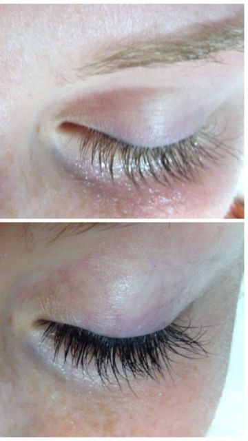 Bellezza Spa's before and after transformation of eyelash tinting Eyelashes Before And After, Eyelash Tinting Before And After, Tint Eyebrows, Eyelash Tint, Eyelashes How To Apply, Eyelashes Quotes, Eyelashes Drawing, Eyebrow Extensions, Before And After Transformation