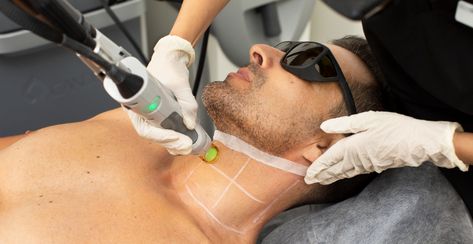 Whether you have had enough of shaving and waxing but are not sure if laser therapy is right for you, aesthetics Mt Kisco might be what you need. Laser Hair Removal Results, Laser Hair Removal Brazilian, Dark Skin Tattoo, Beard Line, Unwanted Hair Permanently, Hair Removal Methods, Hair Removal Device, Regrow Hair, Ipl Hair Removal