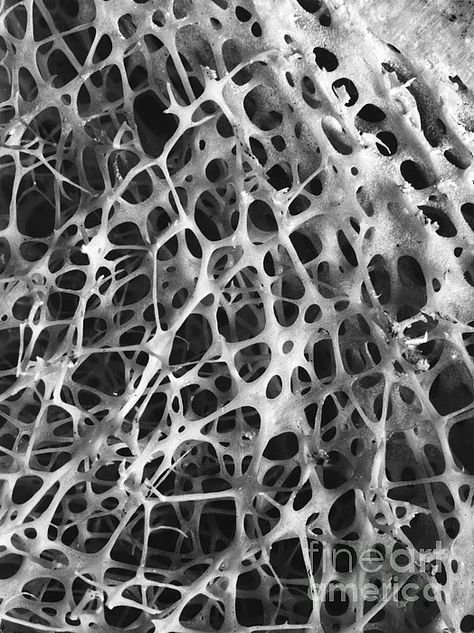 SEM of Human Shin Bone #anatomy #bones #science #biology #giftideas Bone Structure, Tiger Bone Structure, Male Bone Structure, Bone Under Microscope, Structure Of Bone, Biology Art, Texture Graphic Design, Generative Design, Dark Art Tattoo