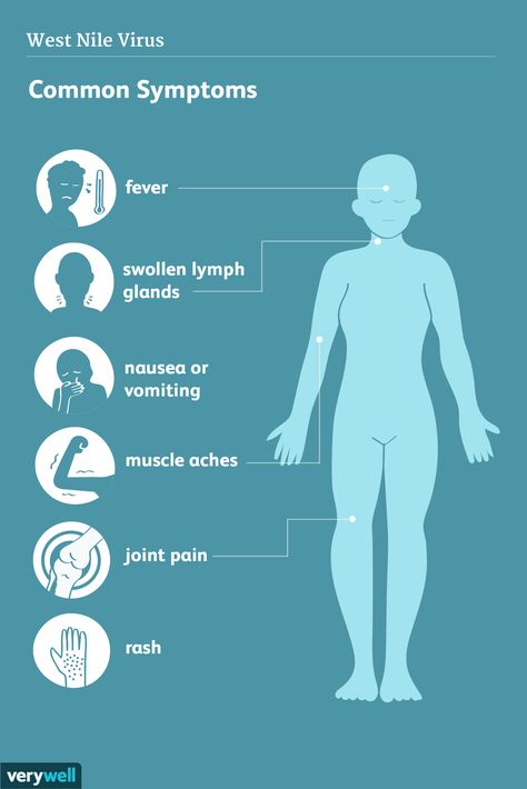 West Nile Virus Symptoms, Virus Symptoms, Lymph Glands, People With Hiv, West Nile Virus, Brain Surgeon, Medical Anatomy, Chest Pain, Muscle Aches