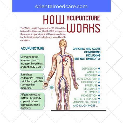 What You’ve Always Wanted To Know About Acupuncture & TCM But Were Afraid To Ask Benefits Of Acupuncture, Physical Therapy Quotes, How Acupuncture Works, Meridian Acupuncture, Benefits Of Acupuncture Mat, Auricular Acupuncture, Chiropractic Therapy, Tcm Traditional Chinese Medicine, Acupuncture Benefits