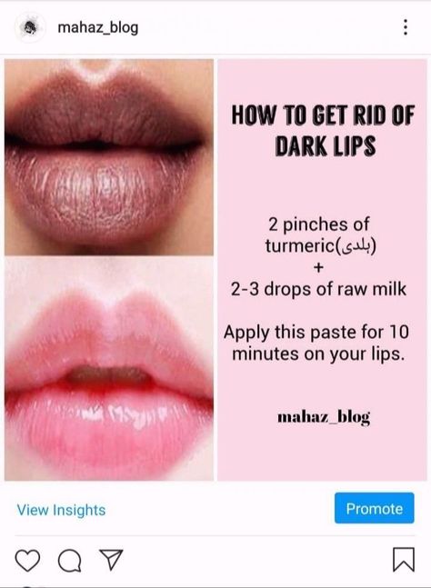 Tips For Dark Lips, How To Lighten Dark Lips Naturally, Lip Mask For Dark Lips, Lip Mask Homemade For Dark Lips, Lip Care For Dark Lips, Dark Lips Remedy Homemade, How To Lighten Lips, How To Lighten Dark Lips, Skin Pigmentation Remedies