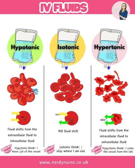 Lauren - Nursing made easy on Instagram: "Understanding IV Fluids: Hypotonic, Isotonic, and Hypertonic Solutions for Student Nurses  1. Isotonic Fluids What They Are: - Isotonic fluids have the same osmolarity as blood plasma (about 275-295 mOsm/L). - They expand the extracellular fluid (ECF) without causing a shift in fluid between compartments.  Common Examples: - 0.9% Sodium Chloride (Normal Saline) - Hartmanns solution - 5% Dextrose in Water (D5W) - initially isotonic, but becomes hypotonic as dextrose is metabolized  Uses: - To treat dehydration - To replace fluid losses (e.g., haemorrhage, surgery) - To maintain fluid balance during surgery  2. Hypotonic IV Fluids What They Are: - Hypotonic fluids have a lower osmolarity than blood plasma (<275 mOsm/L). - They cause water to move int Fluid Electrolyte Balance Nursing, Fluid Balance Nursing, Fluid Volume Deficit Nursing, Isotonic Hypotonic Hypertonic, Extracellular Fluid, Nerdy Nurse, Medical Study, Nursing Study Guide, Amniotic Fluid