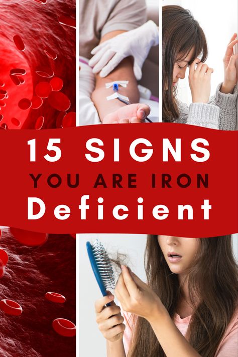 Iron Benefits For Women, Iron Deficiency Symptoms, Increase Iron Levels, Best Iron Supplement, Low Ferritin, Iron Infusion, Signs Of Iron Deficiency, Iron Benefits, Iron Pills