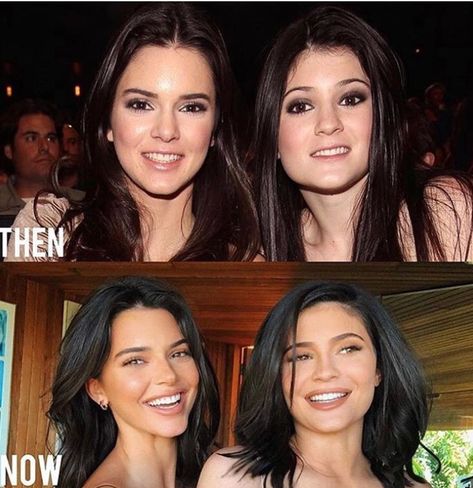 Kendall Jenner Surgery, Kendall Jenner Plastic Surgery, Champagne Makeup, Celebrities Then And Now, Celebrity Plastic Surgery, Celebrities Before And After, Jenner Sisters, Brown Makeup, Makeup Looks For Brown Eyes