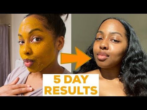 I DID A 5 DAY TURMERIC FACE MASK & This Happened!! || MISS C Beauty - YouTube Tumeric Masks, C Beauty, Diy Turmeric Face Mask, Improve Skin Complexion, Turmeric Mask, Turmeric And Honey, Turmeric Face, Honey Face Mask, Turmeric Face Mask