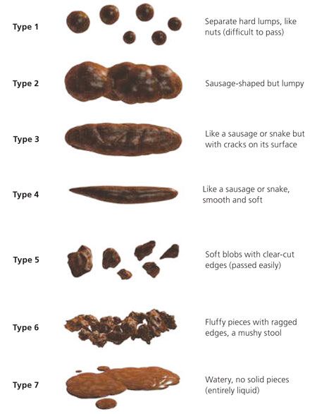 Diagnostic Approach to Chronic Constipation in Adults - American Family Physician Fecal Impaction, Rectal Prolapse, Low Fiber Diet, Constipation Remedies, Pelvic Floor Dysfunction, Abdominal Discomfort, Chronic Constipation, Bowel Movement, Fiber Diet