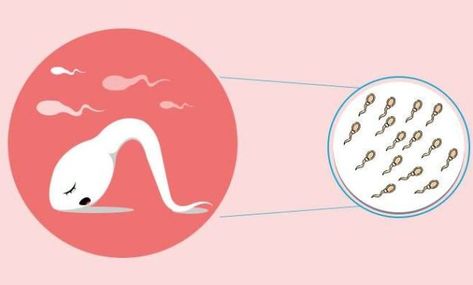 Low Sperm Count: If you are experiencing a Low Sperm Count, you may be wondering what the symptoms, causes, and home remedies are. This article will provide an informative overview… Low Sperm Count, Classy Business Outfits, Sperm Count, Male Fertility, Hormone Imbalance, Regular Exercise, Home Remedies, Make It Yourself, Quick Saves