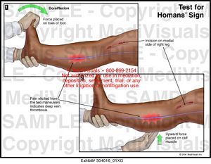 Homans Sign, Single Women Quotes, Nursing 101, Nursing Assessment, Nursing Life, Health Assessment, Pta School, Human Body Unit, Nursing Mnemonics