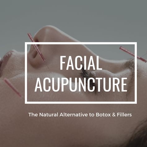 Facial Acupuncture: The Natural Alternative to Botox & Fillers Botox Alternative Products, Facial Acupuncture, Skin Needling, Botox Alternative, Facial Fillers, Anti Aging Mask, Botox Fillers, Botox Injections, Yoga Facial