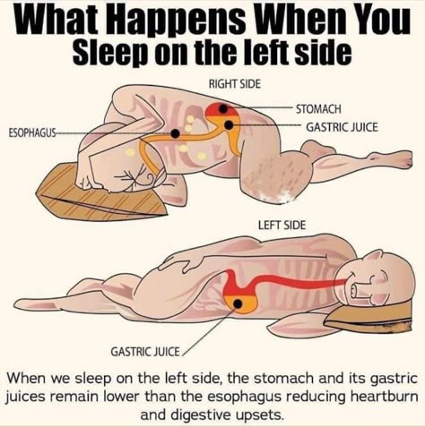 Sleep On Left Side, Whole30 Diet, Gastric Juice, Resep Diet, Health And Fitness Articles, Recipes Diet, Medical Knowledge, When You Sleep, Fitness Articles