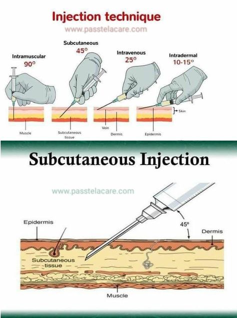 Emt Study, Medical Assistant Student, Nursing Student Tips, Medical Student Study, Pharmacology Nursing, Nursing School Survival, Nursing School Studying, Medical Facts, Medical School Inspiration