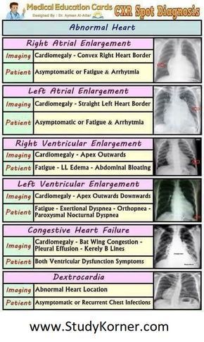 Chest Xray Interpretation, Heart Nursing, Radiology Student, Radiology Imaging, Nursing Assessment, Heart Diseases, Cardiac Nursing, Nursing School Survival, Critical Care Nursing