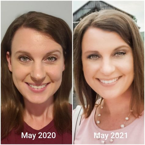 Skincare wrinkles acne longer lashes dark circles healthy skin before and after picture Rodan+Fields Skincare Goals, Skincare Selfcare, Healthy Glowing Skin, Beauty Inside, Puffy Eyes, After Photos, Long Lashes, Rodan And Fields, Healthy Skin Care